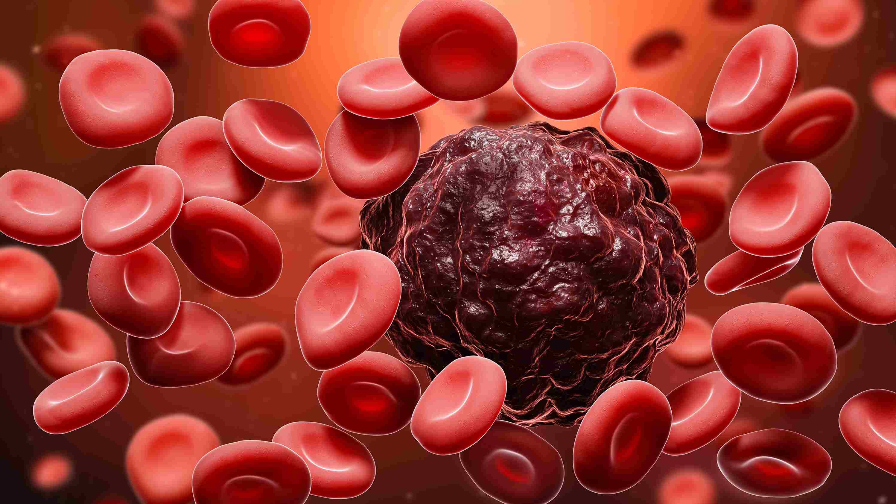 blood cancer